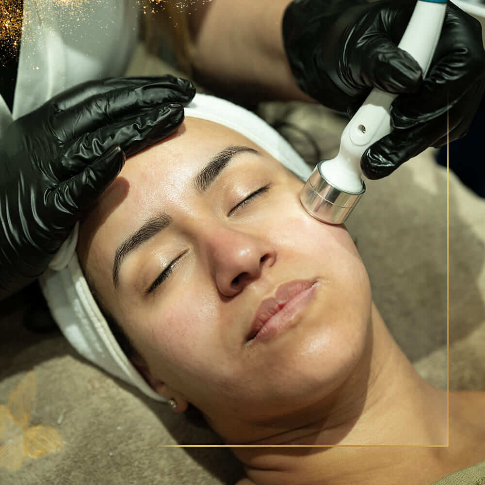 Microneedling Metamorfose Marrakech